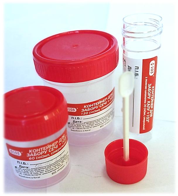 Контейнер для забору сечі +103® 60 (ml) мл, стерильний